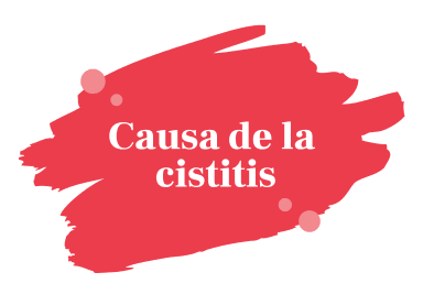 Cause Della Cistite 384x277